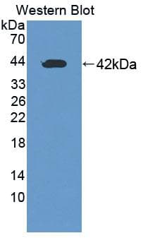 ERBB2 / HER2 Antibody (APC)