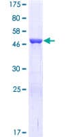 Human TK1 / TK / Thymidine Kinase Protein (Recombinant GST)