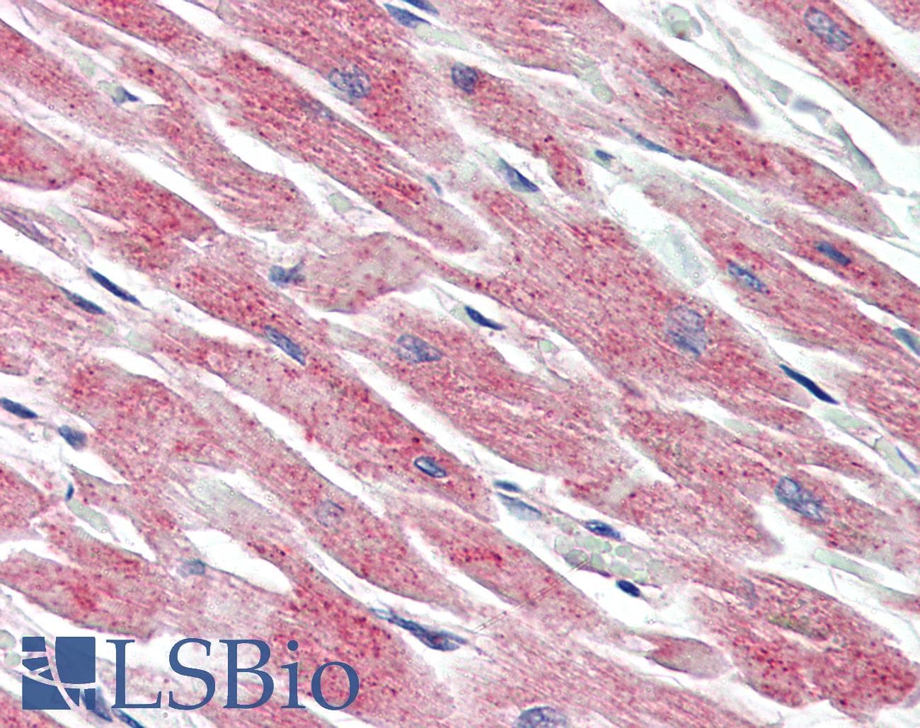 IHC-plus™ Polyclonal Rabbit anti-Human MAP3K5 / ASK1 Antibody (IHC, IF, WB)