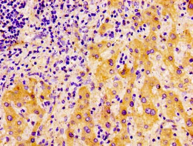 FASN / Fatty Acid Synthase Antibody (aa2155-2495)