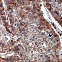 ARHGEF11 Antibody