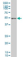 ALDH2 Antibody (clone 1E5)
