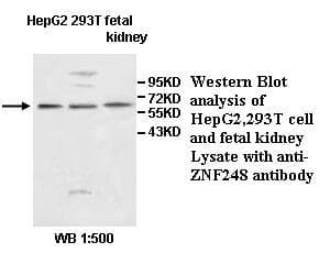 Polyclonal Rabbit anti-Human ZNF248 Antibody (aa162-429, WB)