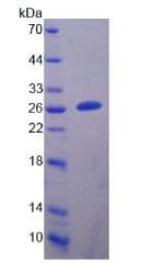 Human DPYSL5 / CRMP5 Protein (Recombinant His-T7, N-terminus)