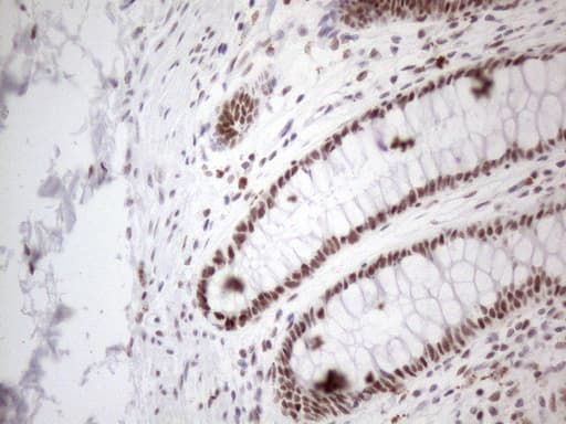 TP53BP1 / 53BP1 Antibody (aa1-300, clone OTI5E1)