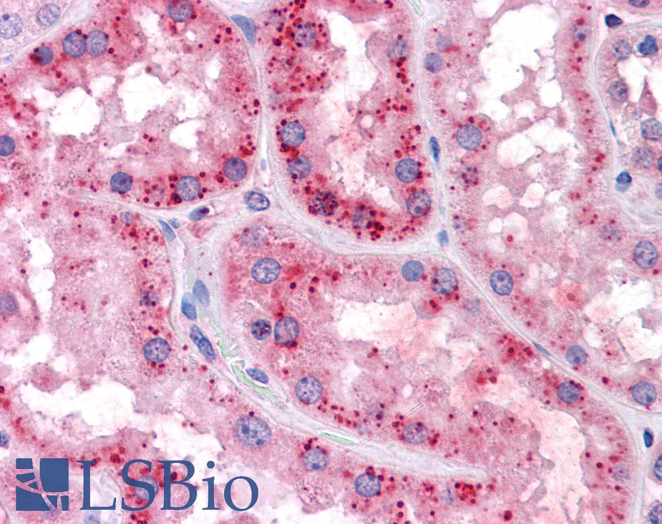 PathPlus™ SLC7A11 / XCT Antibody (aa215-229)