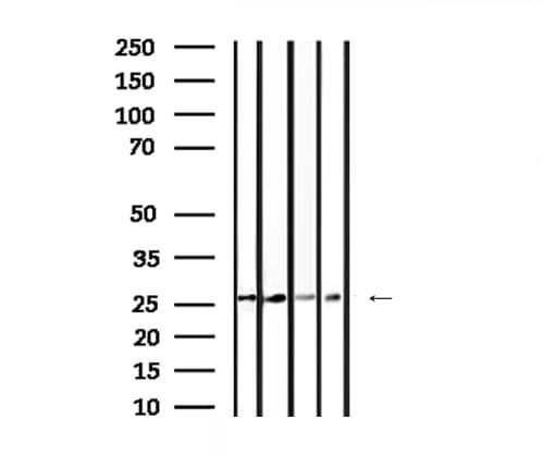 Polyclonal Rabbit anti-Human YWHAG / 14-3-3 Gamma Antibody (IHC, IF, WB)