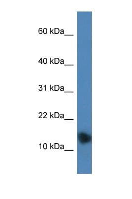 Polyclonal Rabbit anti-Mouse PTHLH / PTHRP Antibody (aa77-126, IHC, WB)