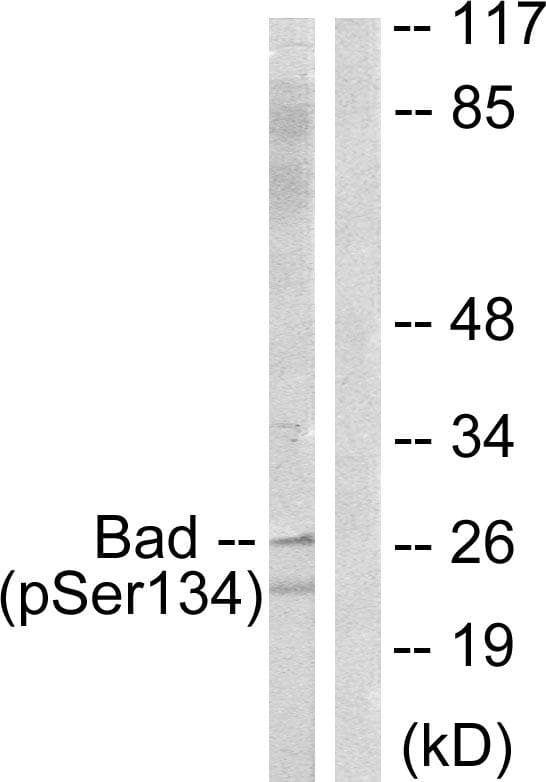 BAD Antibody (phospho-Ser134)