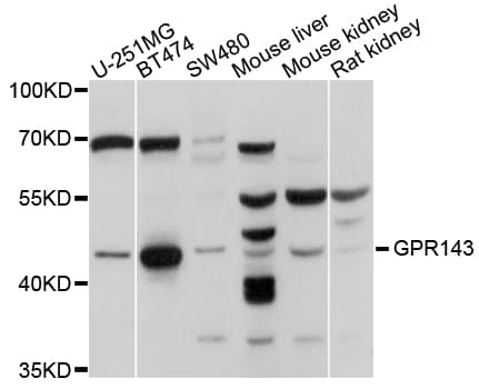 GPR143 Antibody