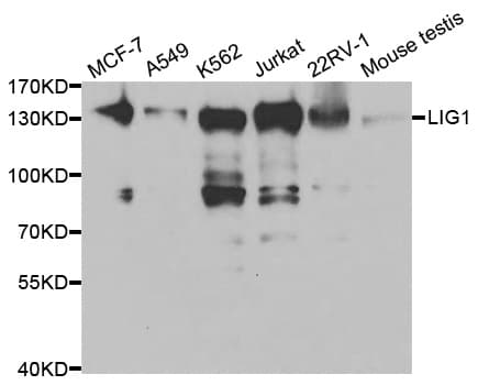 LIG1 / DNA Ligase 1 Antibody
