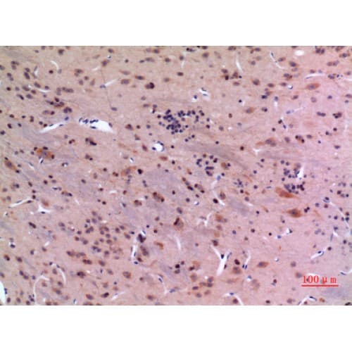 GDI2 Antibody (C-terminal)