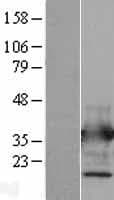 ANXA5 / Annexin V Protein (Over-Expression Lysate Myc-DDK (Flag))