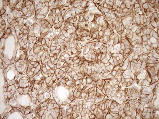 EPLIN Antibody (aa1-275, clone OTI7H5)