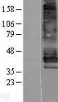 Human EDNRB / Endothelin B Receptor Protein (Over-Expression Lysate Myc-DDK (Flag))