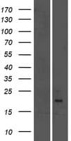 GPLD1 / GPIPLD Protein (Over-Expression Lysate Myc-DDK (Flag))