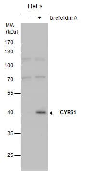 IHC-plus™ CYR61 Antibody (aa47-332)