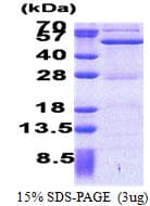 Human ASCC1 Protein (Recombinant His)