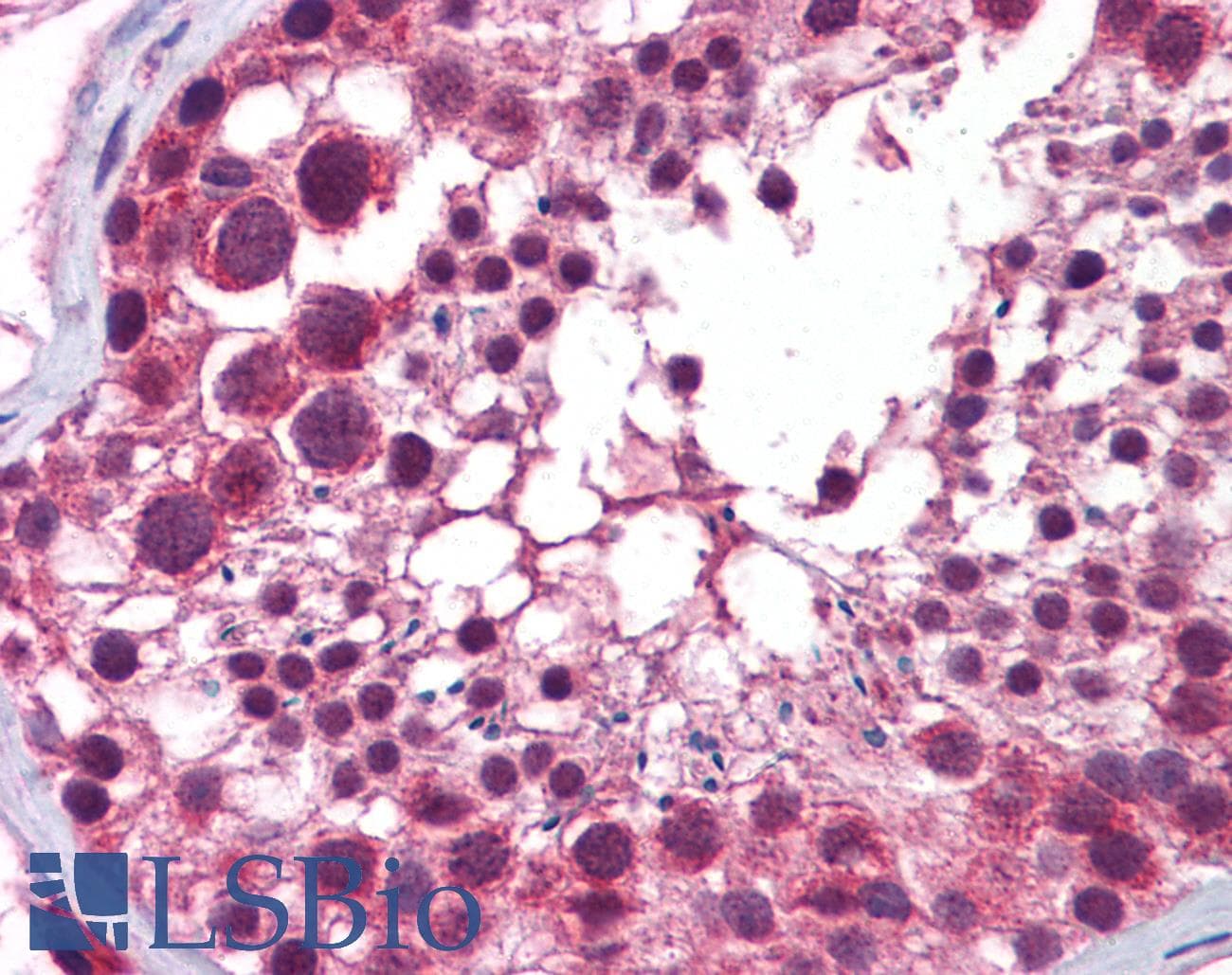 HDAC6 Antibody (N-Terminus)