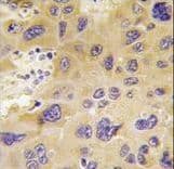 PFKFB1 Antibody (aa13-43)