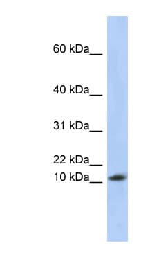 RPL30 / Ribosomal Protein L30 Antibody (aa35-84)