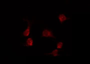 KDELR1 / HDEL Antibody