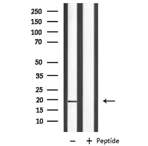 Leptin Antibody