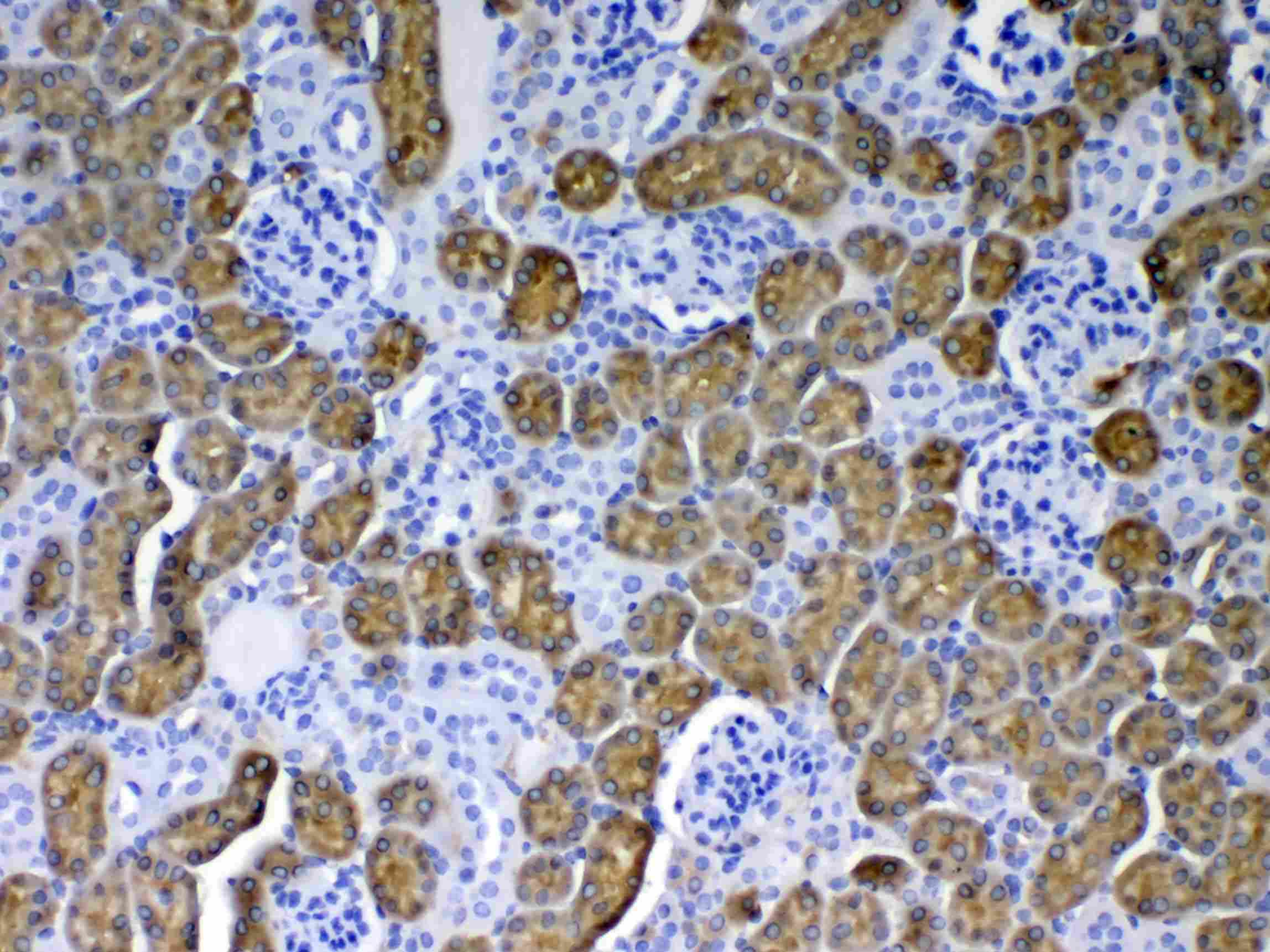 PH / PAH Antibody