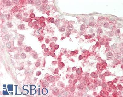 IHC-plus™ Polyclonal Rabbit anti-Human PRKAR1A Antibody (IHC, IF, WB)