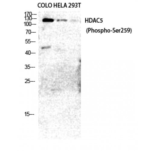 Histone Deacetylase HDAC5 / HDAC9 Antibody (phospho-Ser259/220)