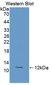 CETP Antibody (aa353-470)