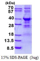 Human WBP2 Protein (Recombinant His)