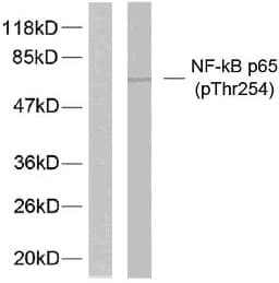 Polyclonal Rabbit anti-Human RELA / NFKB p65 Antibody (phospho-Thr254, IHC, WB)
