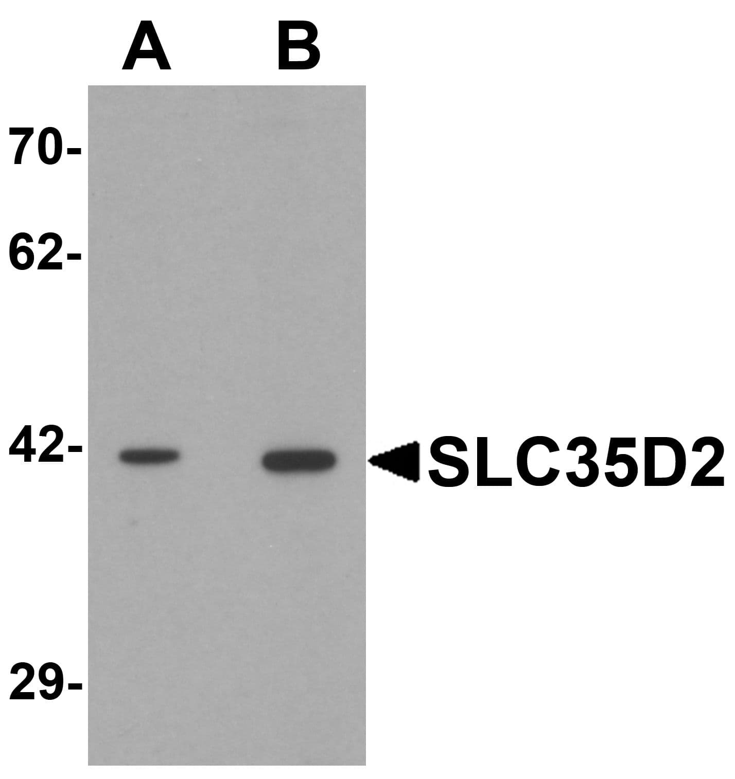 IHC-plus™ SLC35D2 Antibody
