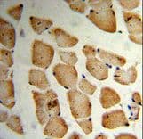 Polyclonal Rabbit anti-Human MVD Antibody (aa7-34, IHC, WB)