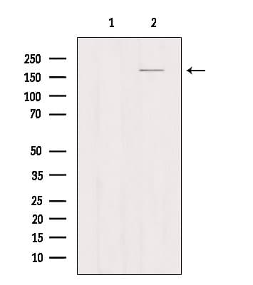 Mannose Receptor / CD206 Antibody