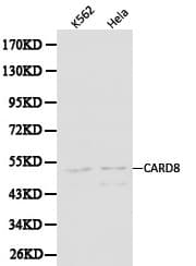 CARD8 / Cardinal / TUCAN Antibody