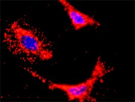 PIK3CB / PI3K Beta Antibody (clone 4H2)