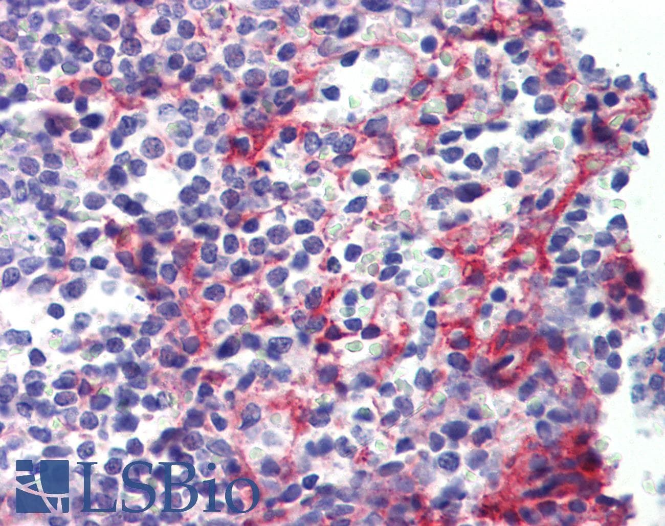 IHC-plus™ Monoclonal Mouse anti-Human PDGFRB / PDGFR Beta Antibody (clone 42G12, IHC, WB)