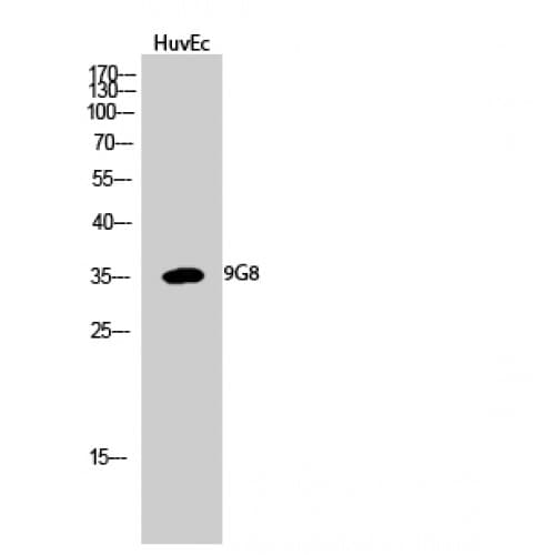 SFRS7 / 9G8 Antibody (30-110 aa, Internal)