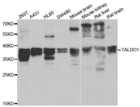 TALDO1 / Transaldolase 1 Antibody
