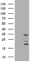 Monoclonal Mouse anti-Human ABCB1 / MDR1 / P Glycoprotein Antibody (clone OTI5E3, WB)