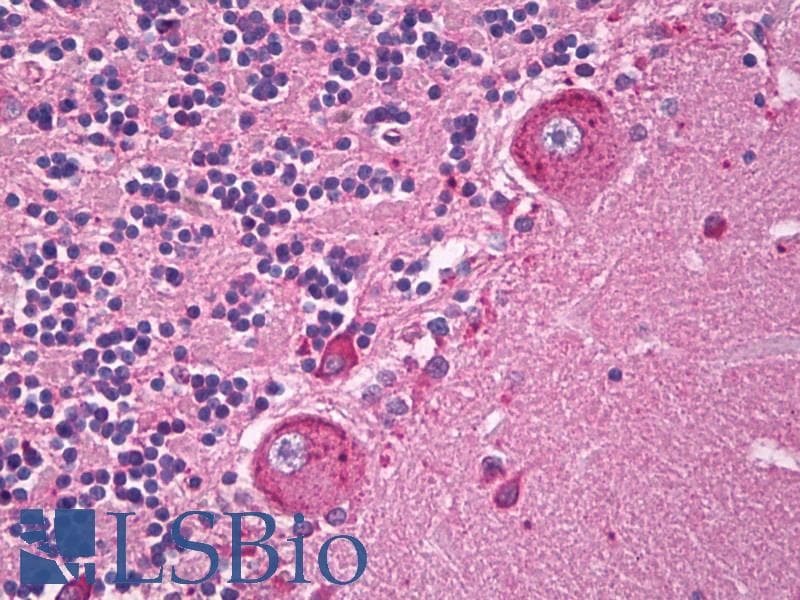 TRPC5 Antibody (aa827-845, clone S67-15, AP)
