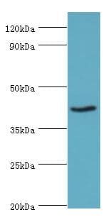 PRMT1 Antibody (aa20-353)
