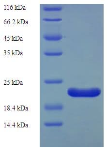 Rat REG3A Protein (Recombinant His)