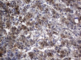 Monoclonal Mouse anti-Human TSC22D1 / TSC22 Antibody (clone OTI1G1, IHC, WB)