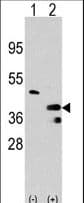 IHC-plus™ Polyclonal Rabbit anti-Human PRMT1 Antibody (aa316-347, IHC, WB)