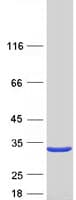 Human DTD1 Protein (Recombinant Myc-DDK (Flag))