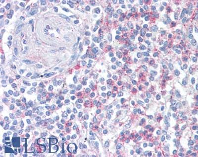 IHC-plus™ PTPRJ / CD148 Antibody