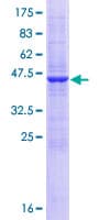 Human SSR2 Protein (Recombinant GST)